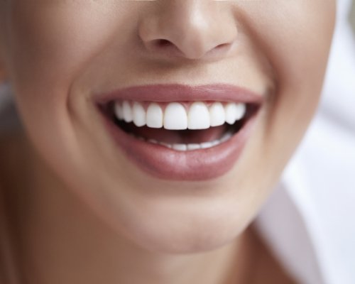 Close up of a smiling woman with white teeth and an even gumline