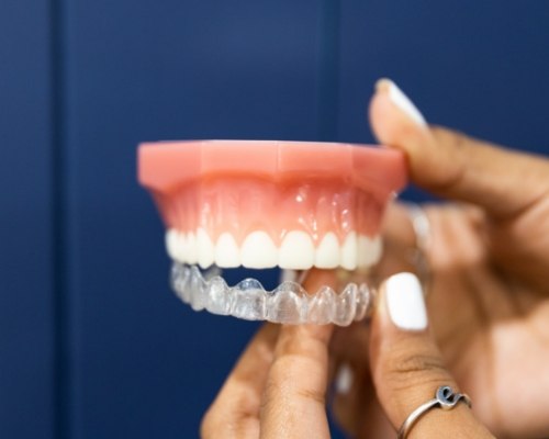 Invisalign clear aligner being placed over a model of a row of teeth