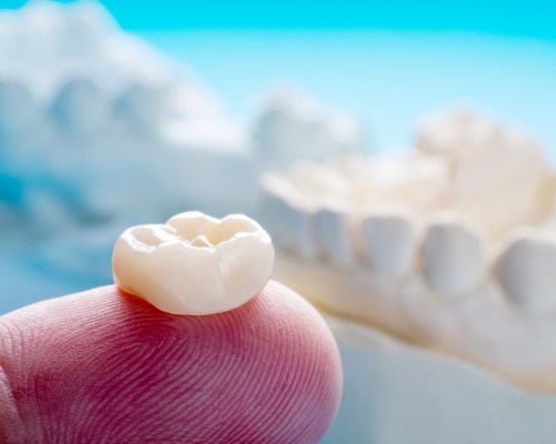 Dentist holding a dental crown on their finger