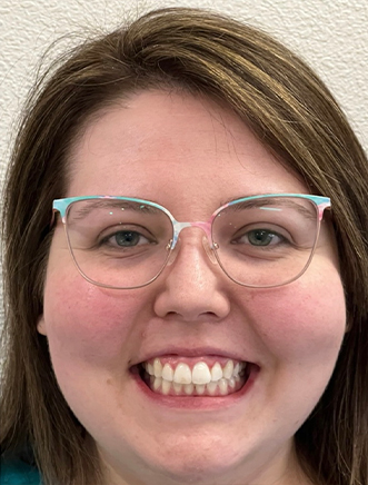 Smiling woman showing off her perfectly aligned teeth