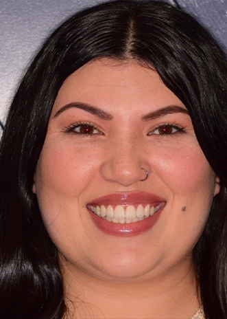 Smiling young woman with aligned teeth after dental treatment