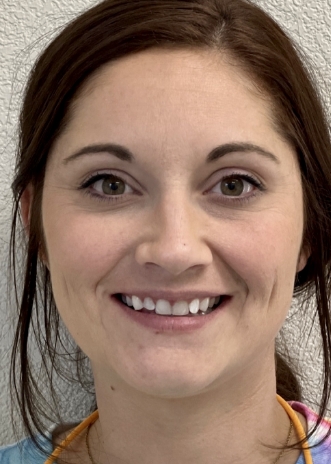 Close up of a smile with discolored and damaged teeth