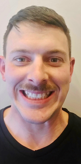 Smiling man with mustache and misaligned teeth