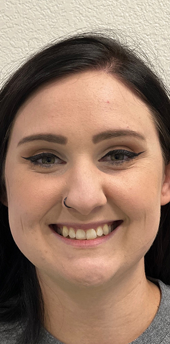 Smiling young woman with winged eyeliner and discolored teeth