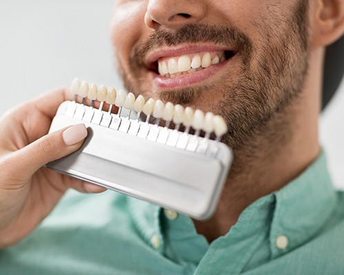 a dentist holding up a shade chart to a man’s teeth