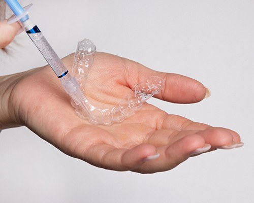 Hands applying whitening gel to custom-fitted trays