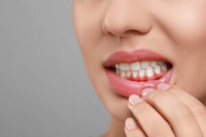 Person showing gingivitis in their mouth. 