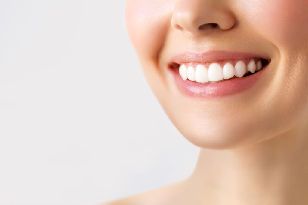 Nose-to-neck view of woman smiling with bright white teeth
