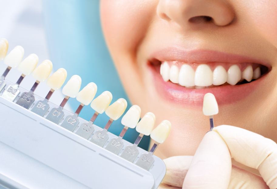 Dentist showing patient veneers