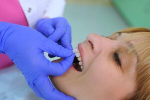 Dentist applying veneers to patient's front tooth.